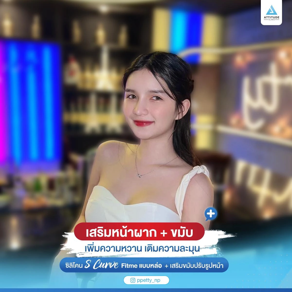 เสริมหน้าผาก เสริมขมับ