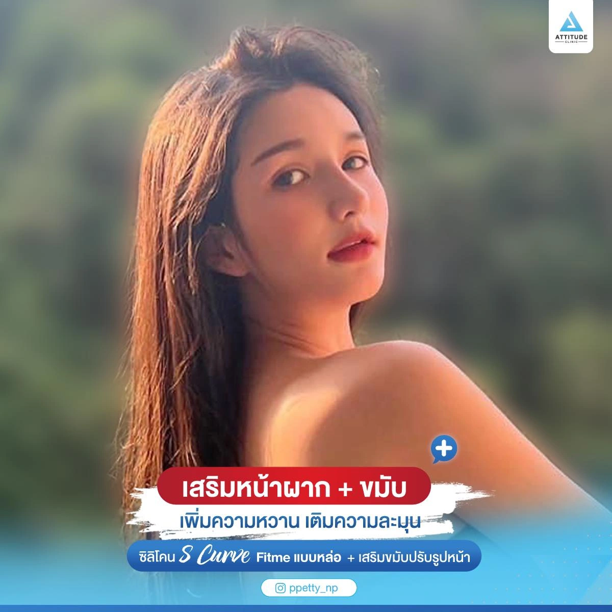 เสริมหน้าผาก เสริมขมับ