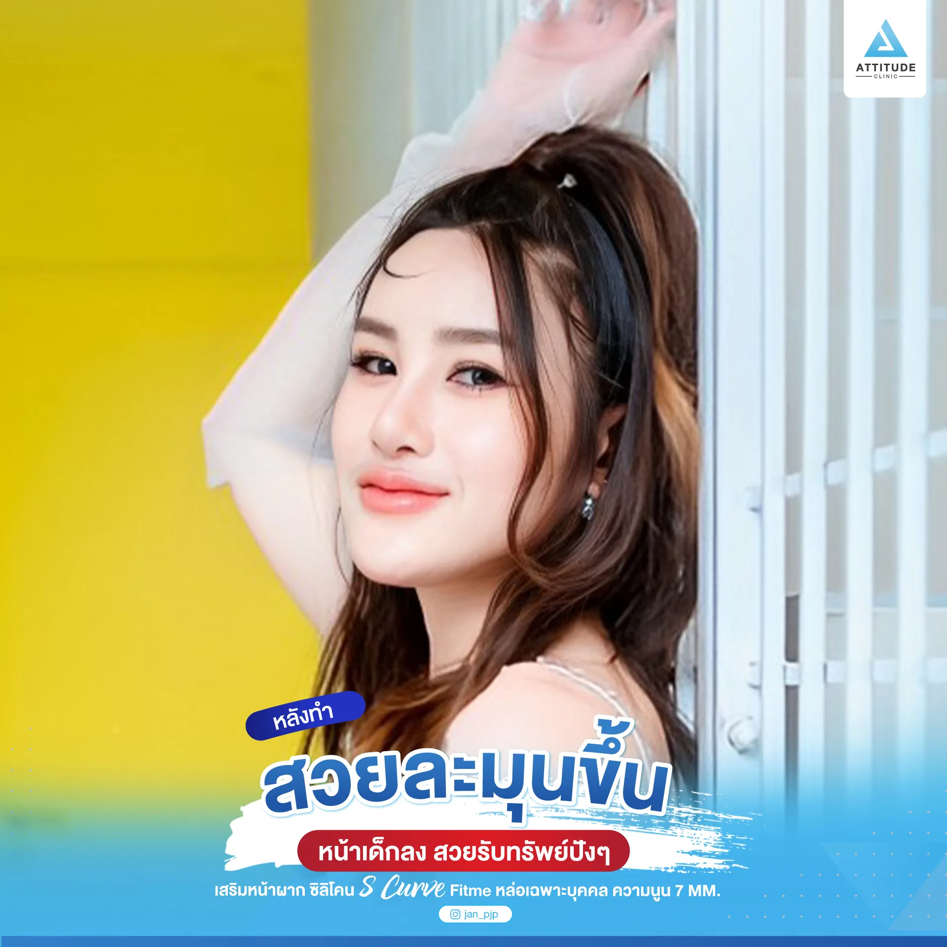 เสริมหน้าผาก