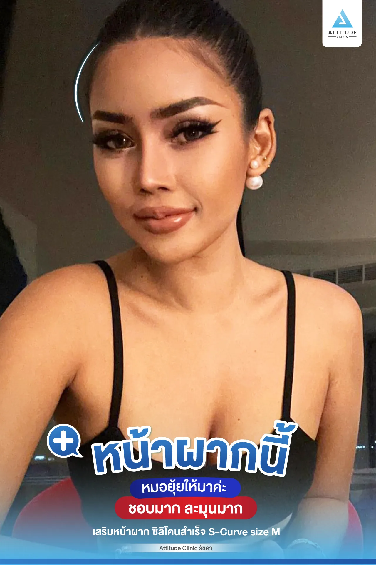 เสริมหน้าผาก