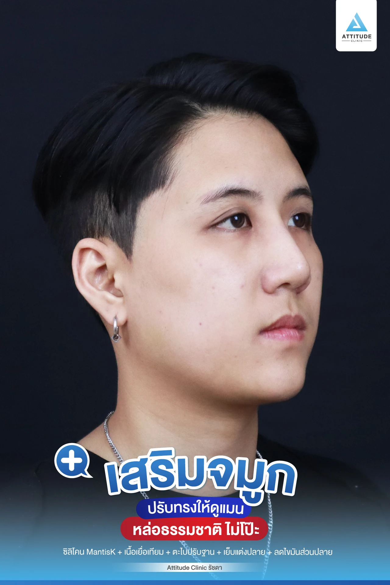 เสริมจมูก