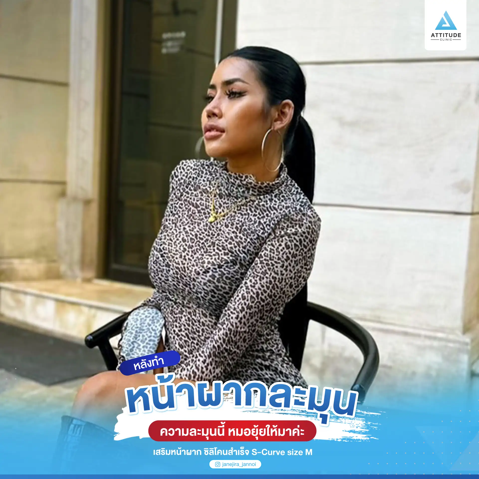 เสริมหน้าผาก
