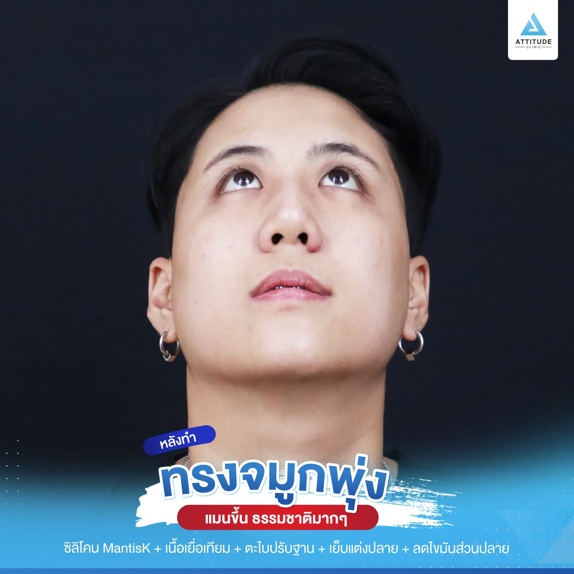 เสริมจมูก