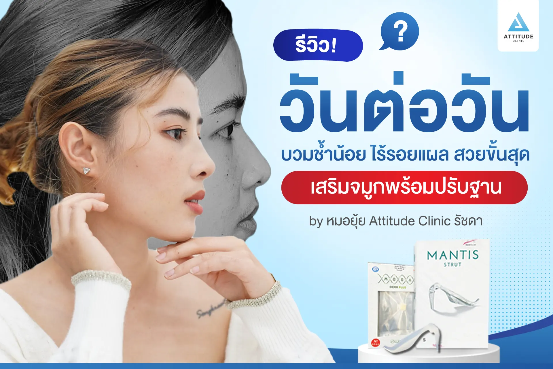 เสริมจมูก