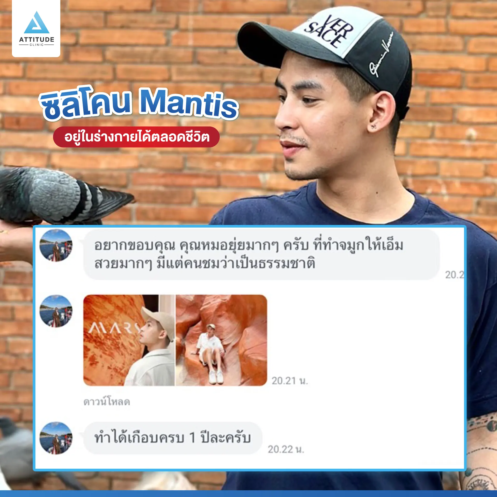 เสริมจมูก