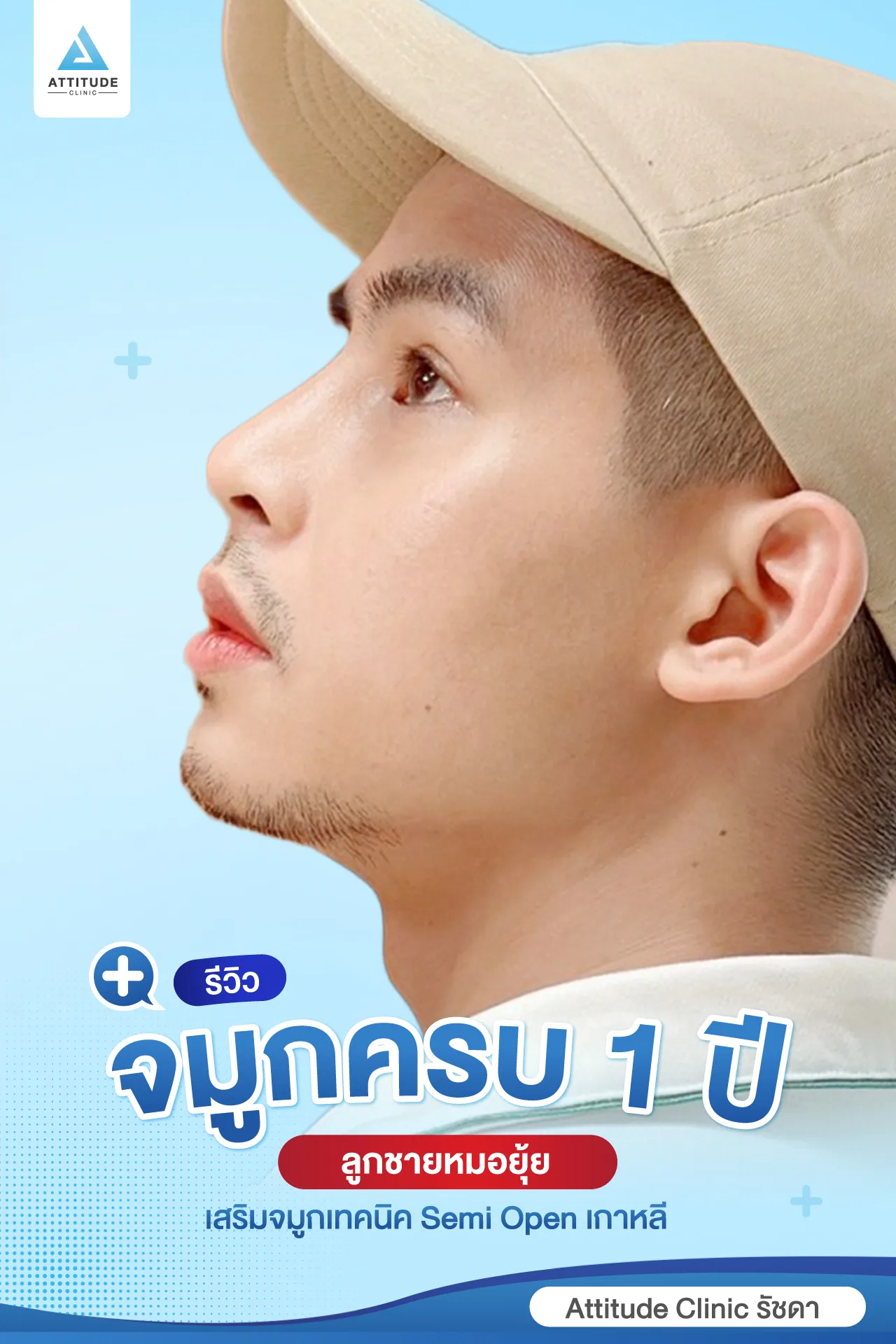 เสริมจมูก
