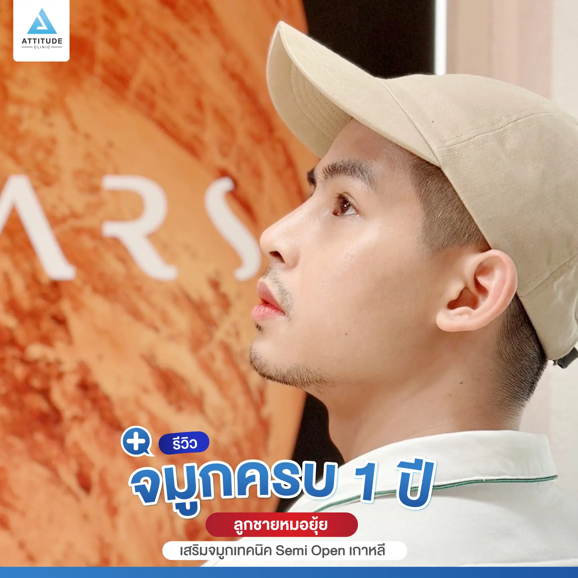 เสริมจมูก