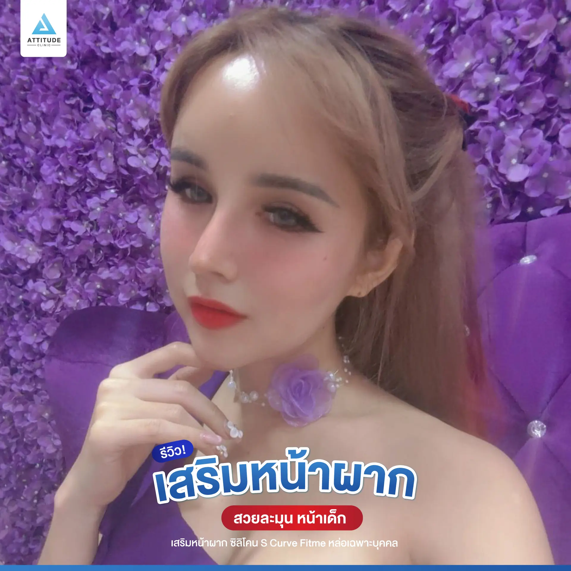 เสริมหน้าผาก