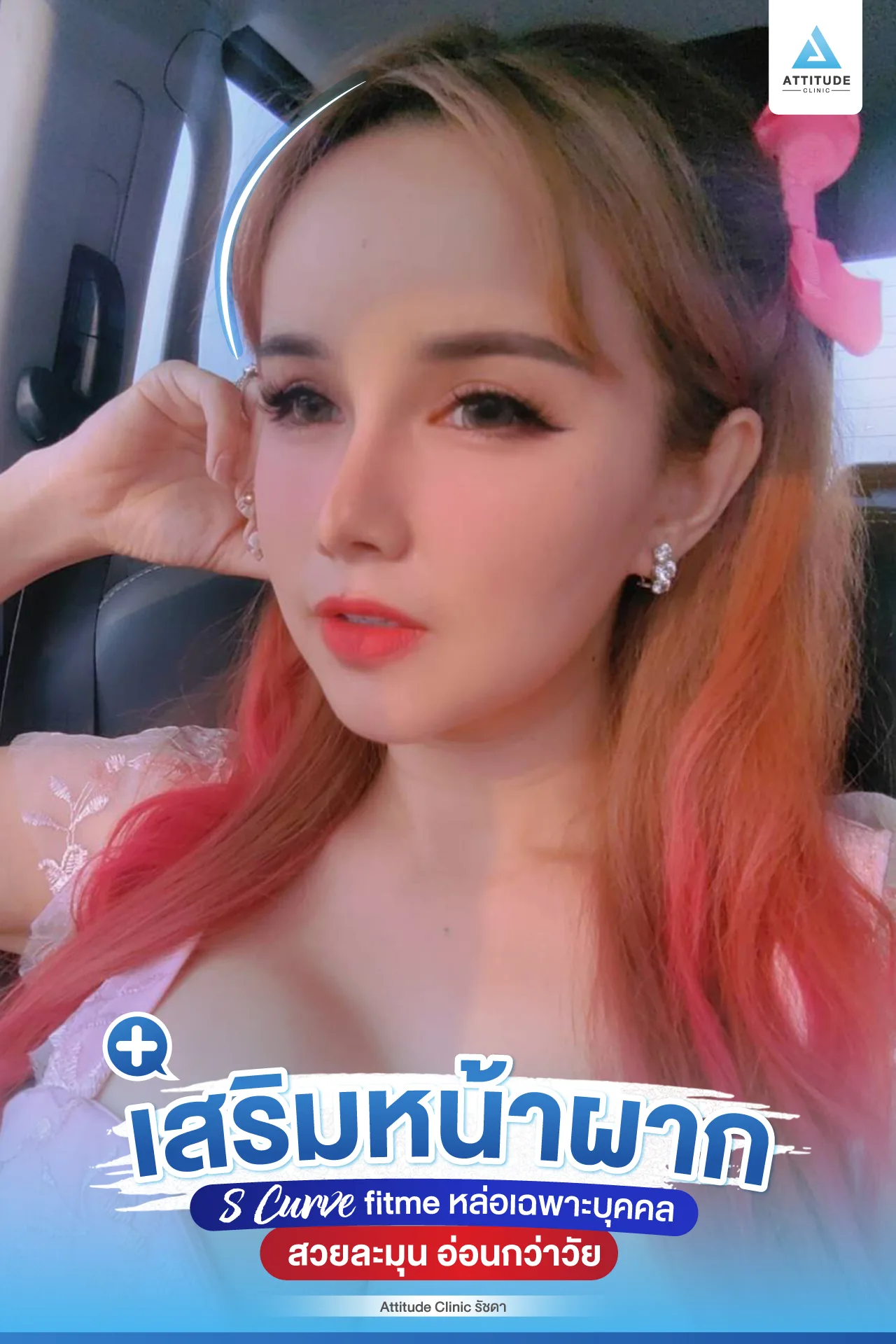 เสริมหน้าผาก
