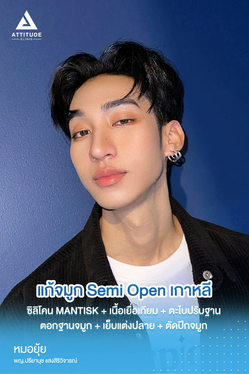 แก้จมูก