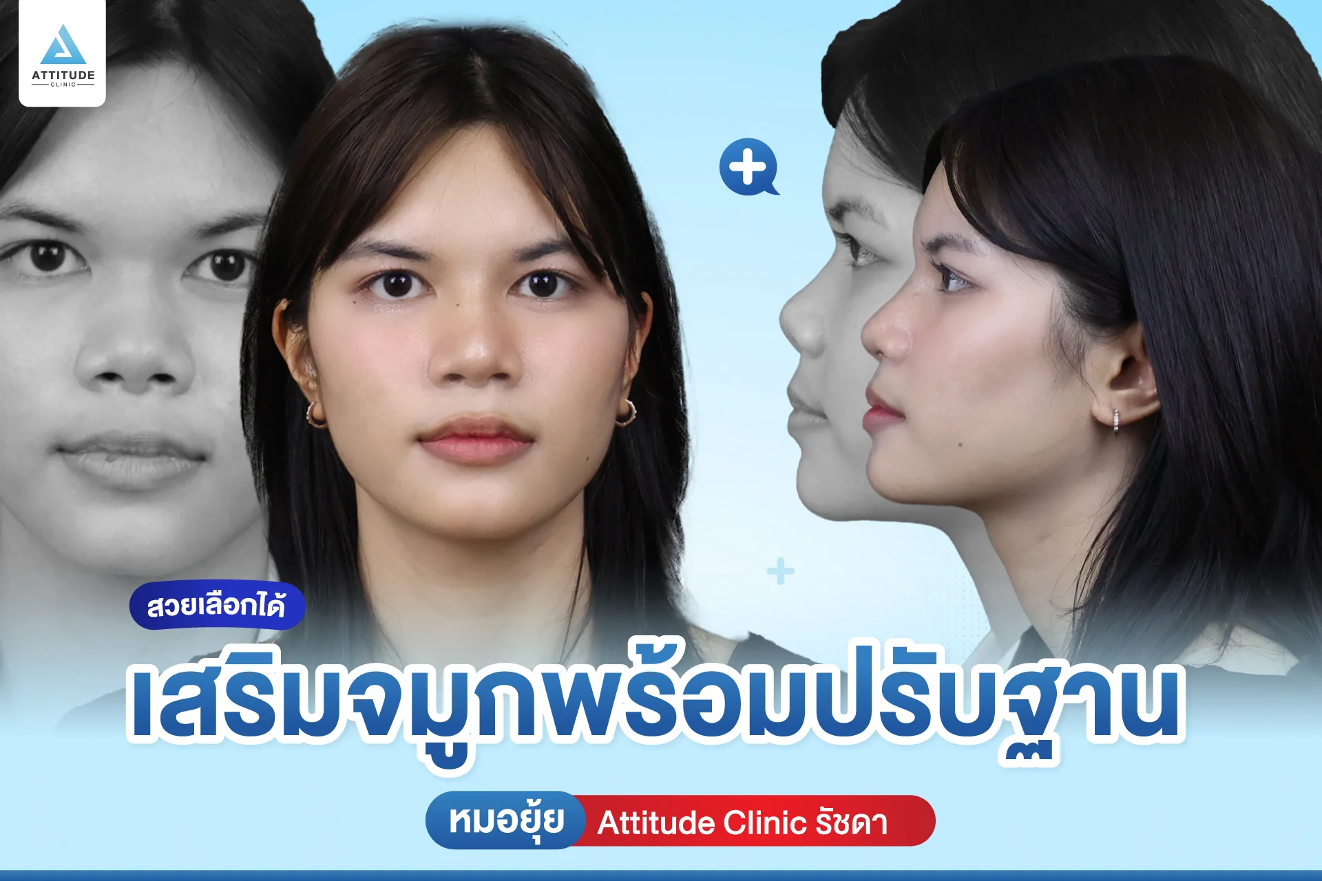เสริมจมูก