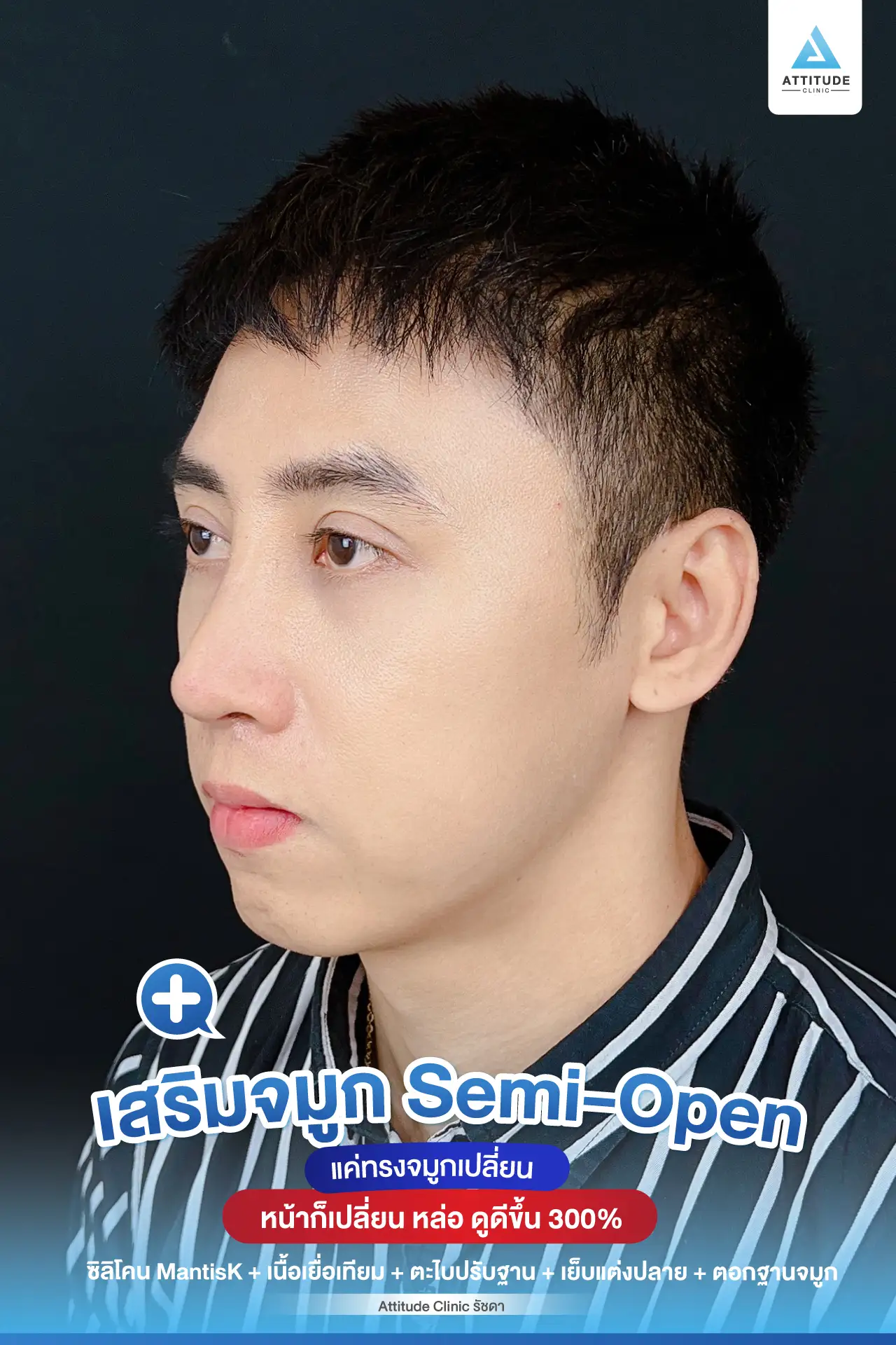 เสริมจมูก