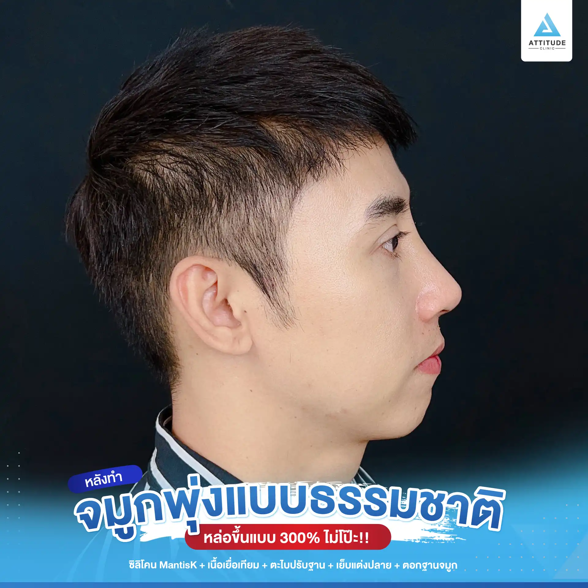 เสริมจมูก
