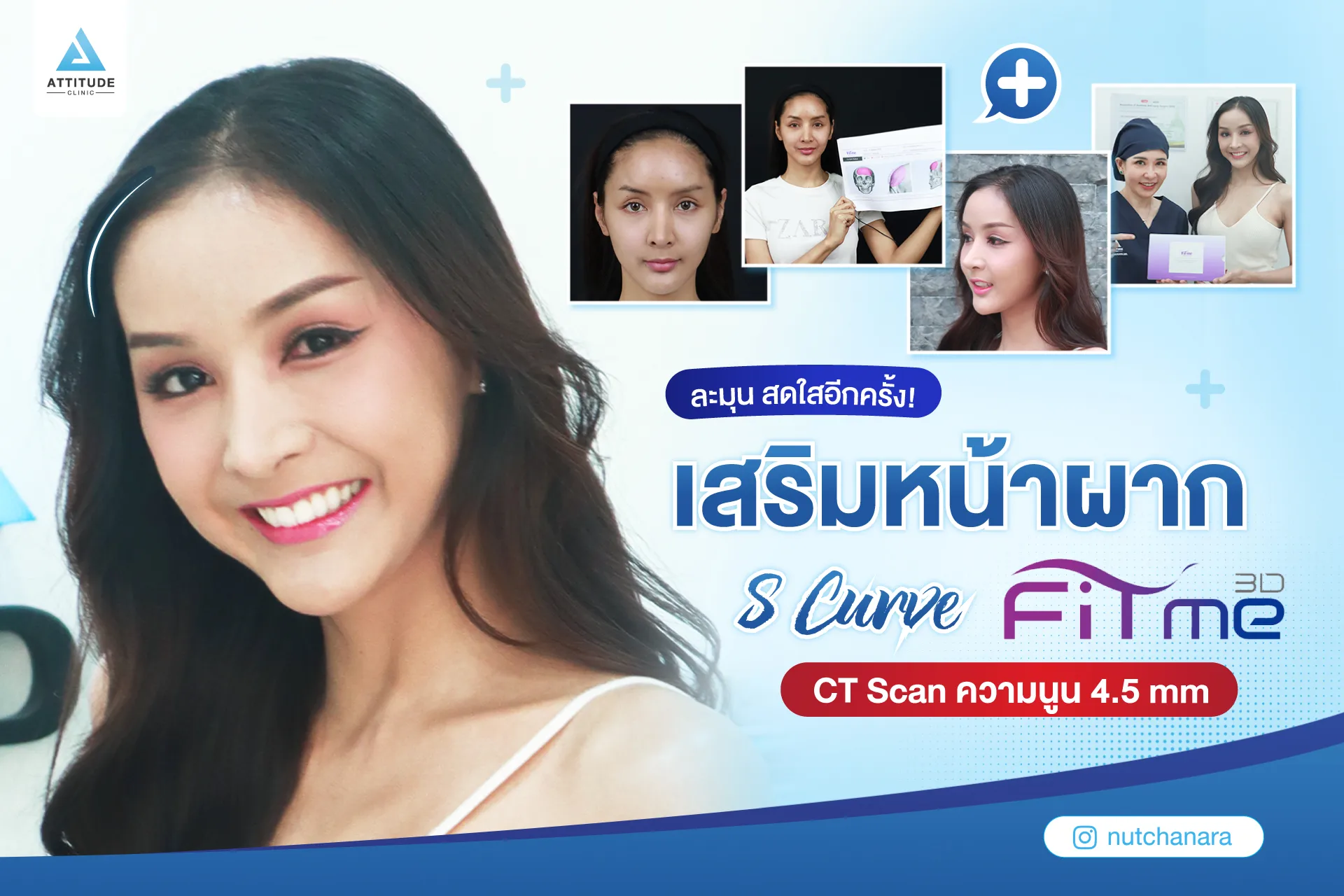 เสริมหน้าผาก