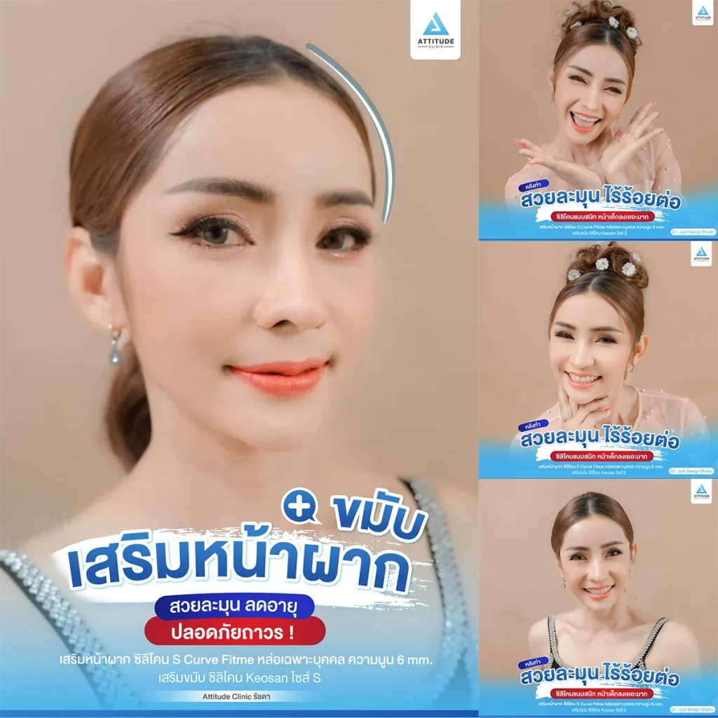 เสริมหน้าผาก