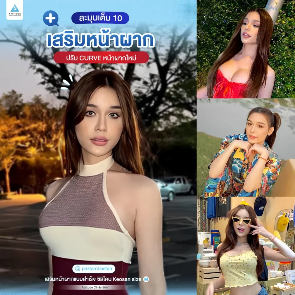 เสริมหน้าผาก