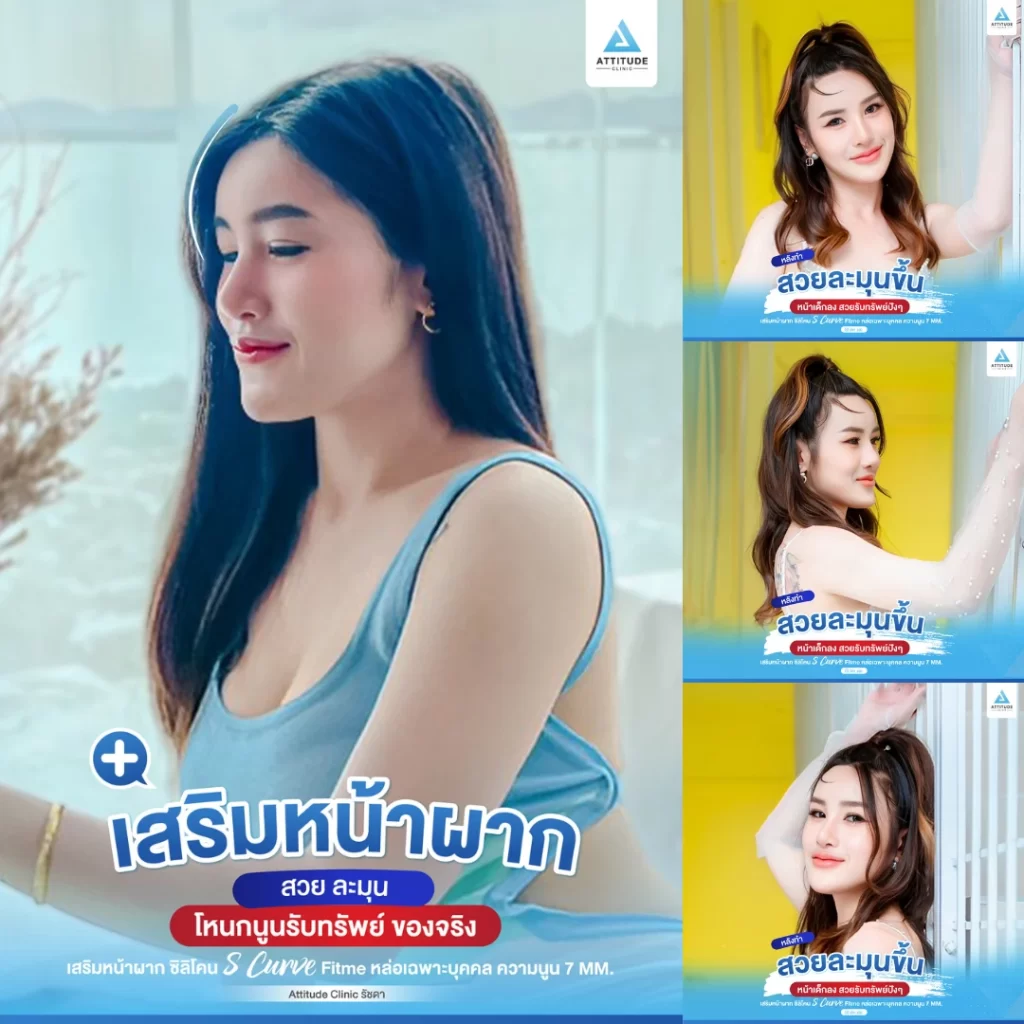 เสริมหน้าผาก