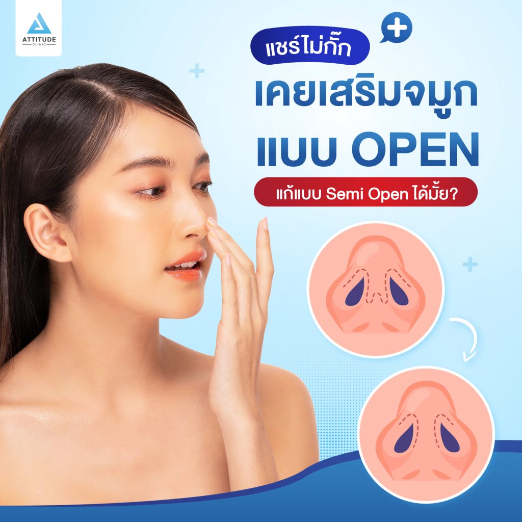 เสริมจมูก