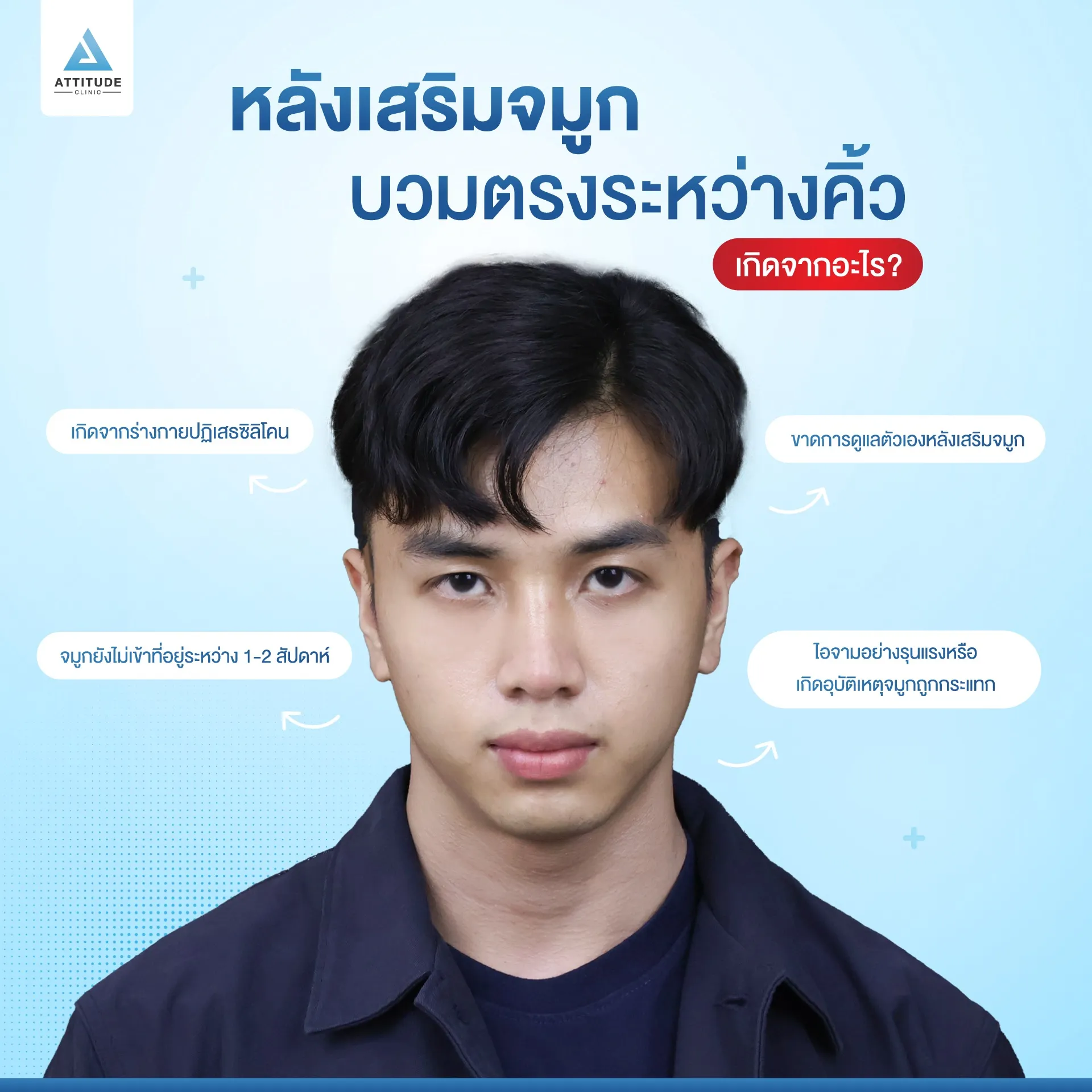 เสริมจมูก