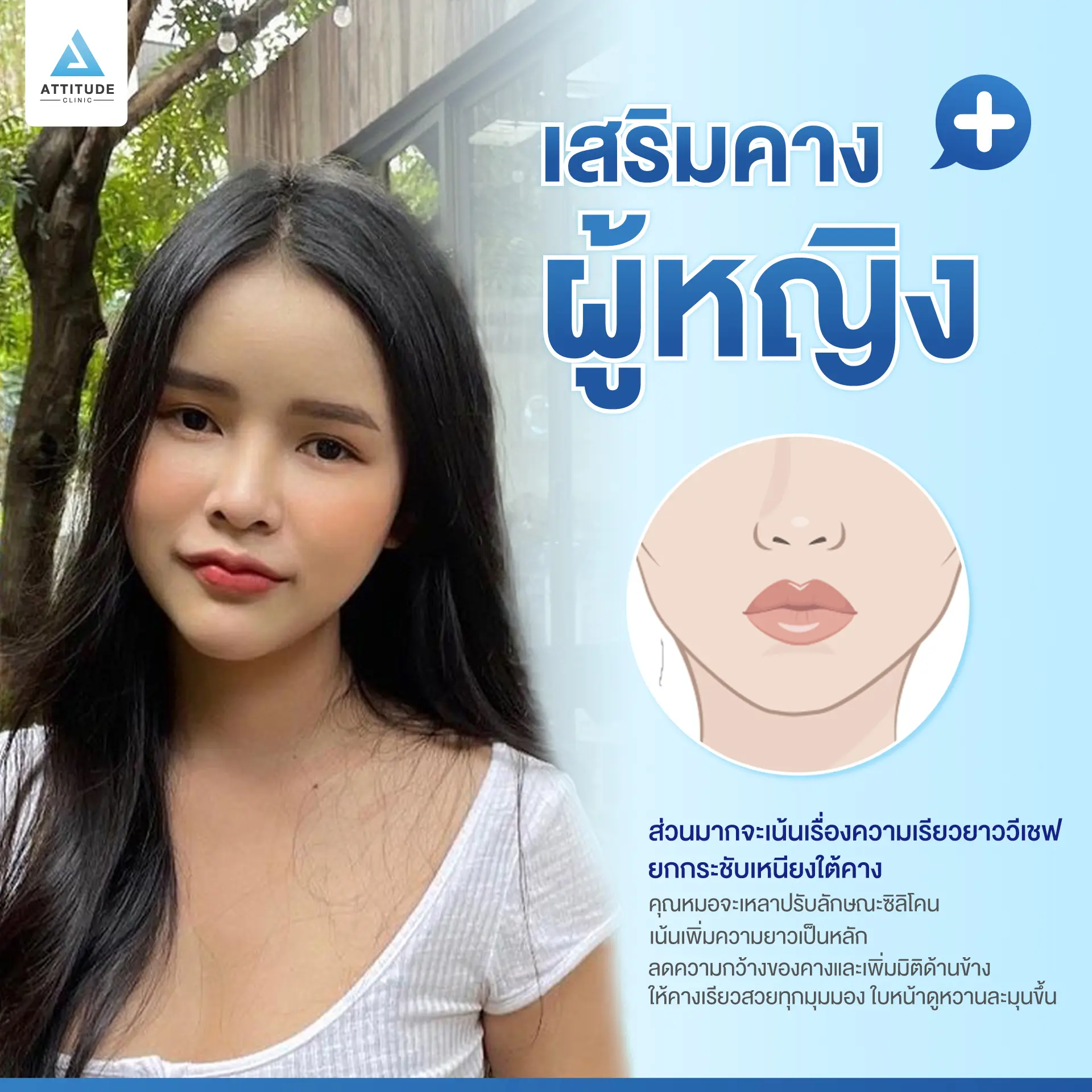 เสริมคาง