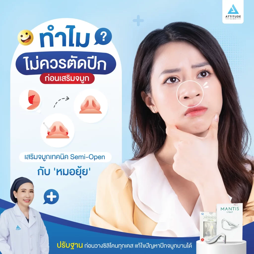 ตัดปีกจมูก