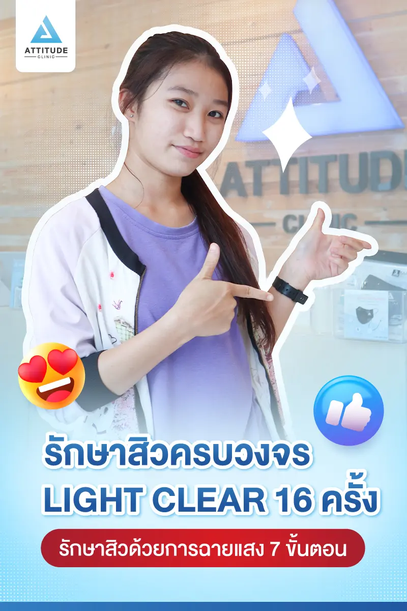 รีวิวรักษาสิว ด้วยการฉายแสง Light Clear 7 ขั้นตอน จำนวน 16 ครั้ง ของคุณเขมจิรา ที่มีปัญหาสิวและรอยสิว 