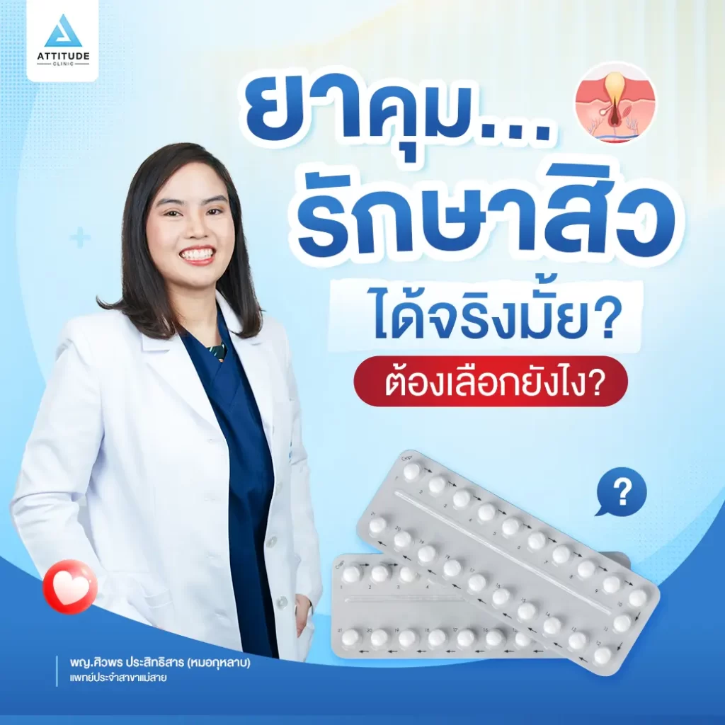 ยาคุมรักษาสิวได้จริงมั้ย