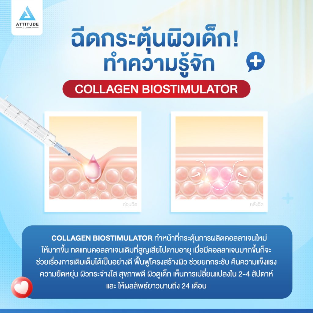 ฉีดกระตุ้นให้ผิวเด็ก ทำความรู้จัก Collagen Biostimulator ทำไมช่วงนี้วงการความงามถึงพูดกันบ่อย คืออะไร? ดีจริงมั้ย? เชื่อได้ป่าว? ไปหาคำตอบพร้อมกัน!