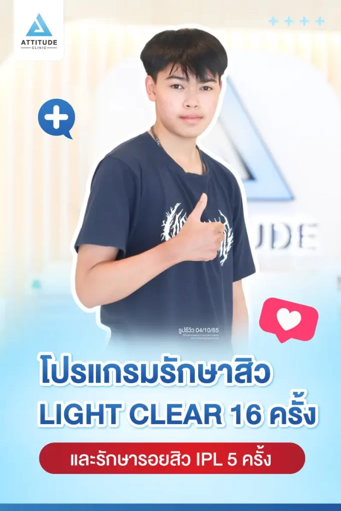 รีวิวรักษาสิวคุณท็อป ด้วยการฉายแสง Light Clear 7 ขั้นตอน จำนวน 16 ครั้ง และทำ IPL หน้าใส ลดรอยสิว จำนวน 5 ครั้ง รักษาสิวอักเสบ สิวอุดตัน และรอยแดงจากสิวทั่วใบหน้าที่ Attitude Clinic