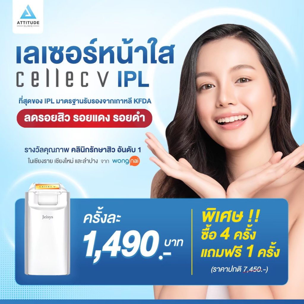 Cellec V IPL เลเซอร์หน้าใส IPL ลดรอยสิว ผิวกระจ่างใส กระชับรูขุมขน เครื่องใหม่ล่าสุดจากเกาหลี ตอบโจทย์ทุกปัญหาผิวได้จริงหรือไม่ ? ดีกว่ารุ่นอื่นอย่างไร ? มีคำตอบก่อนตัดสินใจเลือกใช้บริการ