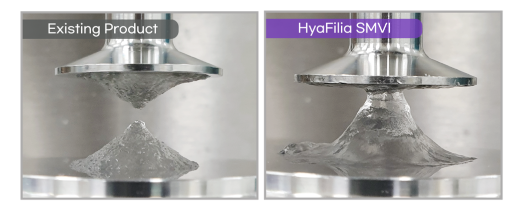 ฟิลเลอร์ Hyafilia filler