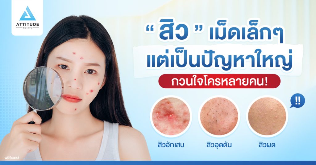 รักษาสิว สิวหายจริง จนต้องบอกต่อ ไม่เลี้ยงไข้ ยืนยันกว่าหมื่นเคส Attitude Clinic รักษาสิวครบวงจรจากต้นเหตุสิว หมอดูแลเองทุกเคส มั่นใจ หายห่วง!