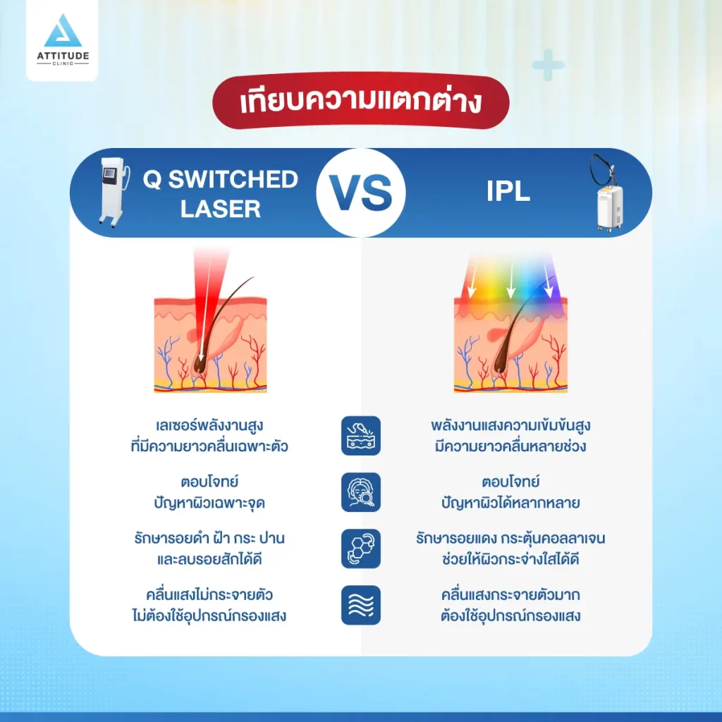 ข้อมูลครบ! Q Switched Laser พารู้จักเลเซอร์หน้าใส รักษาฝ้า กระ จุดด่างดำ ฟื้นฟูผิวให้กระจ่างใส เรียบเนียน ไร้รอยกวนใจ Yag Q Switched Laser คืออะไร? Q Switched Laser รีวิว? Q Switched Laser กี่ครั้งเห็นผล? Q Switched Laser 1 ครั้ง ราคา?