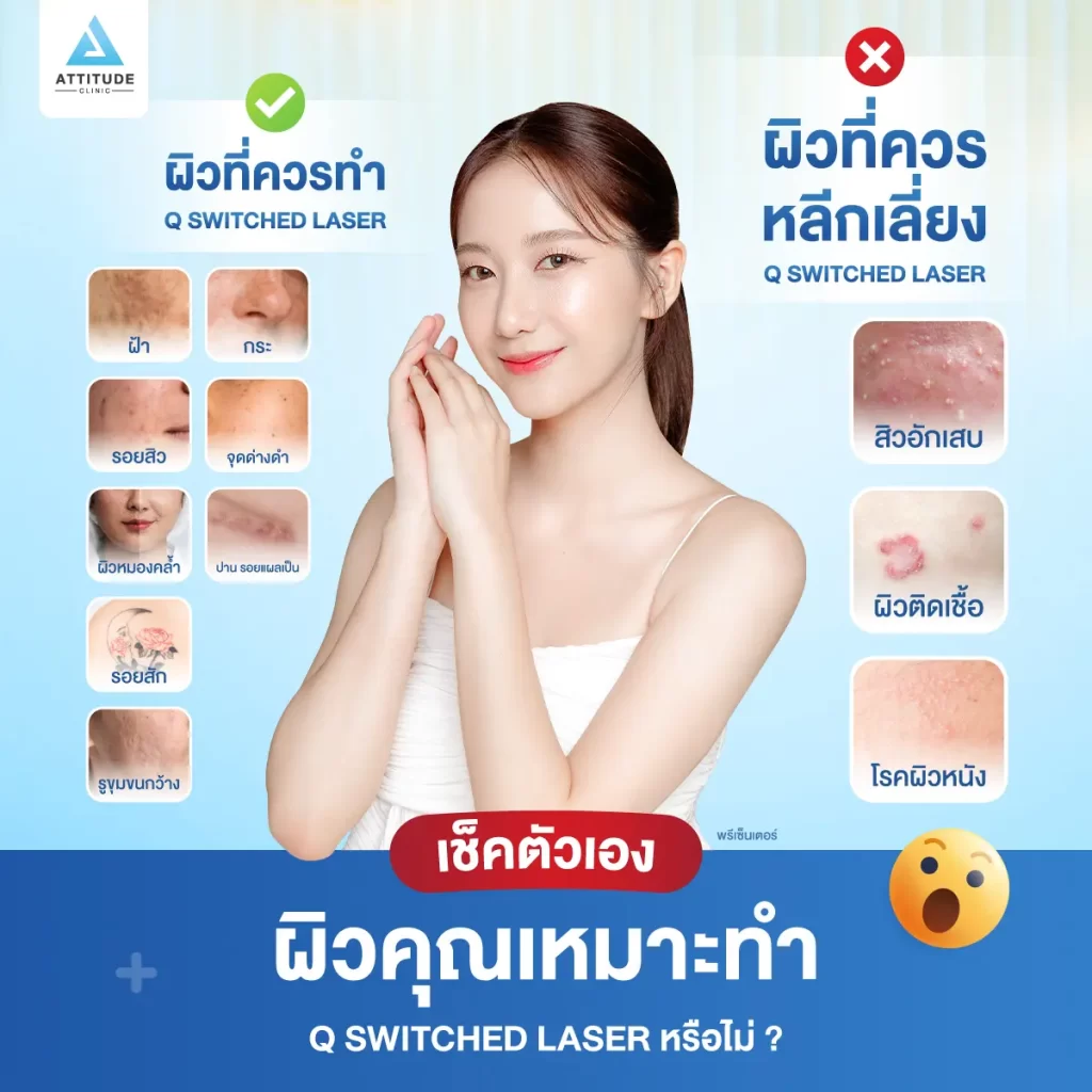 ข้อมูลครบ! Q Switched Laser พารู้จักเลเซอร์หน้าใส รักษาฝ้า กระ จุดด่างดำ ฟื้นฟูผิวให้กระจ่างใส เรียบเนียน ไร้รอยกวนใจ Yag Q Switched Laser คืออะไร? Q Switched Laser รีวิว? Q Switched Laser กี่ครั้งเห็นผล? Q Switched Laser 1 ครั้ง ราคา?