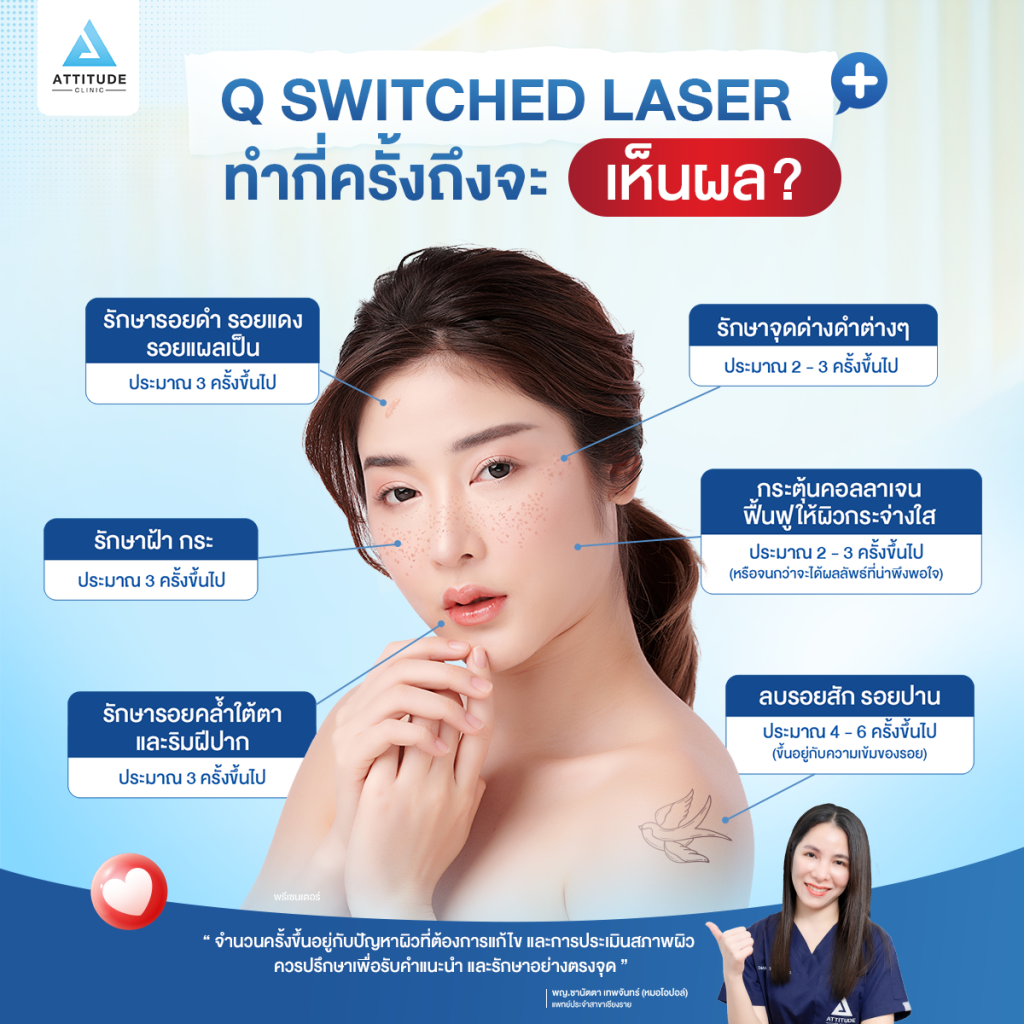 เลเซอร์หน้าใส Q Switched Laser เทคโนโลยีคลื่นแสงพลังงานสูง ลดการสร้างเม็ดสี ให้ผิวกระจ่างใส ไร้รอยกวนใจ ต้องทำกี่ครั้งเห็นผล ?