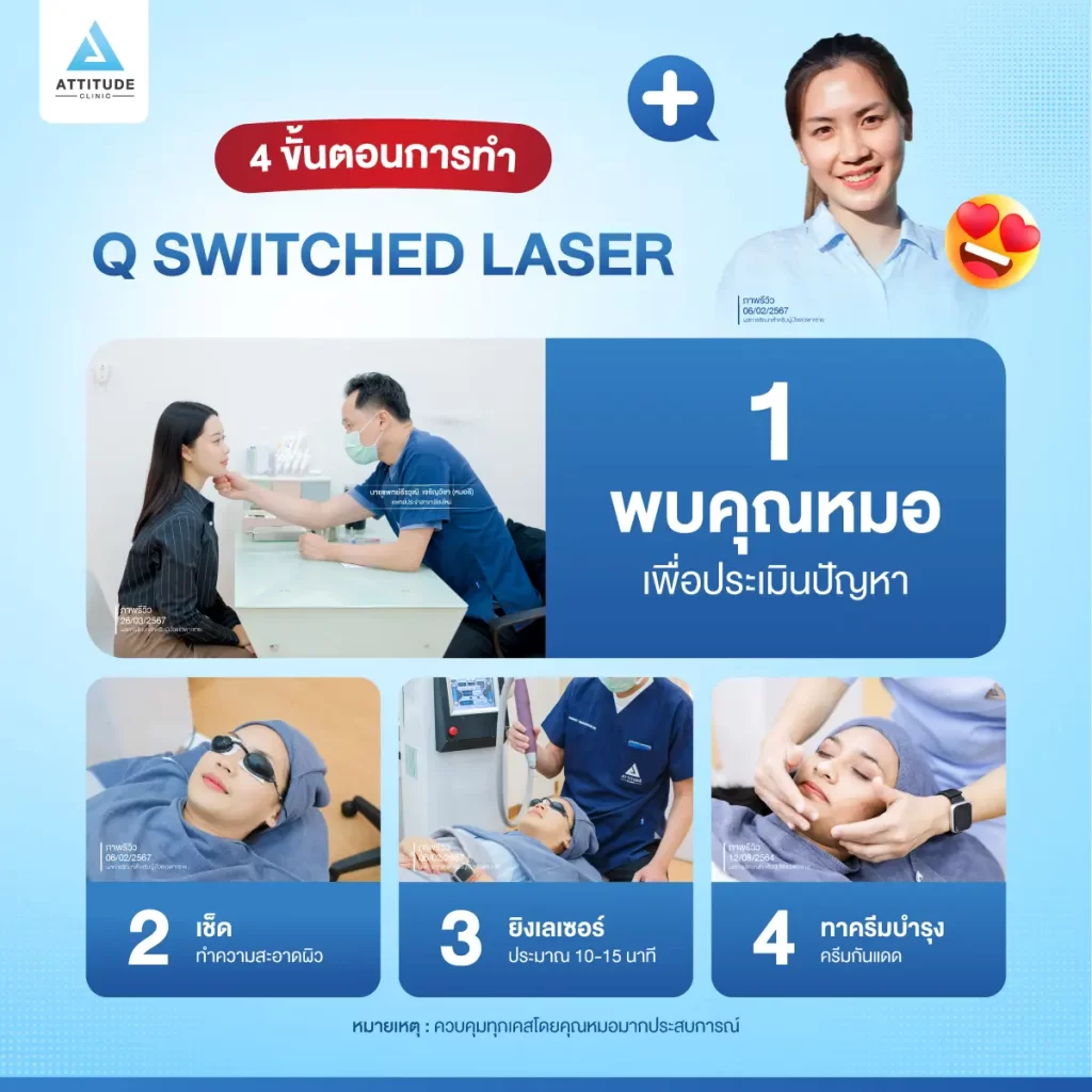 ข้อมูลครบ! Q Switched Laser พารู้จักเลเซอร์หน้าใส รักษาฝ้า กระ จุดด่างดำ ฟื้นฟูผิวให้กระจ่างใส เรียบเนียน ไร้รอยกวนใจ Yag Q Switched Laser คืออะไร? Q Switched Laser รีวิว? Q Switched Laser กี่ครั้งเห็นผล? Q Switched Laser 1 ครั้ง ราคา?