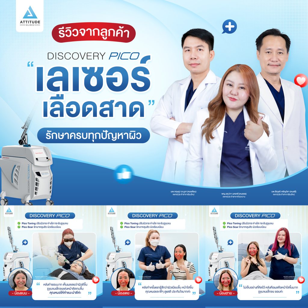 รีวิวทำ Discovery Pico จากลูกค้า เลเซอร์เลือดสาด ตัวดังจากอิตาลี รักษาครบทุกปัญหาผิว