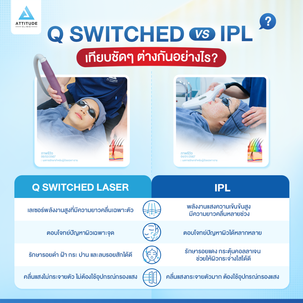 ไขข้อสงสัย?! Q Switched Laser กับ IPL ที่แอททิจูดต่างกันอย่างไร ?