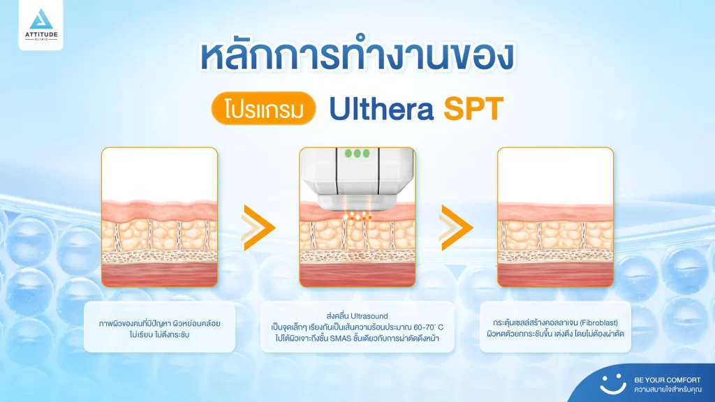 ข้อมูลครบ! Ulthera SPT ก่อนตัดสินใจทำอัลเทอร์ร่า ยกกระชับผิว ปรับรูปหน้า ลดริ้วรอย Ulthera คืออะไร? อัลเทอร์ร่า เหมาะกับใคร? ราคาทำ Ulthera 1 ครั้ง? ทํา Ulthera อยู่ได้นานแค่ไหน? Ulthera เชียงราย อัลเทอร์ร่า เชียงราย เร็วๆ นี้ที่ Attitude Clinic เชียงราย