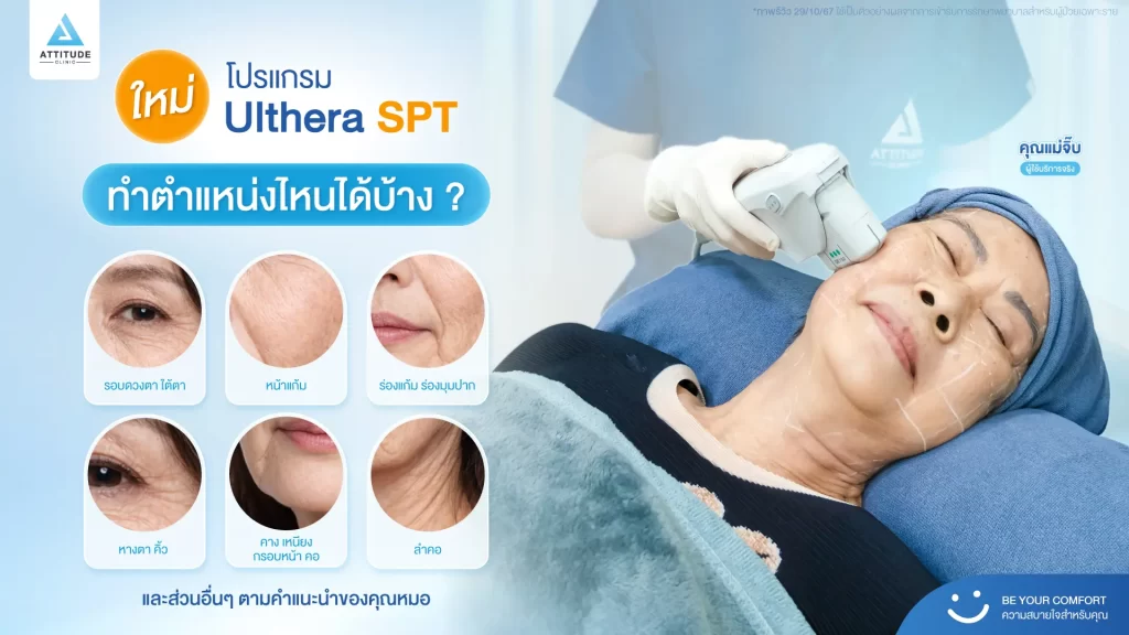 ข้อมูลครบ! Ulthera SPT ก่อนตัดสินใจทำอัลเทอร์ร่า ยกกระชับผิว ปรับรูปหน้า ลดริ้วรอย Ulthera คืออะไร? อัลเทอร์ร่า เหมาะกับใคร? ราคาทำ Ulthera 1 ครั้ง? ทํา Ulthera อยู่ได้นานแค่ไหน? Ulthera เชียงราย อัลเทอร์ร่า เชียงราย เร็วๆ นี้ที่ Attitude Clinic เชียงราย