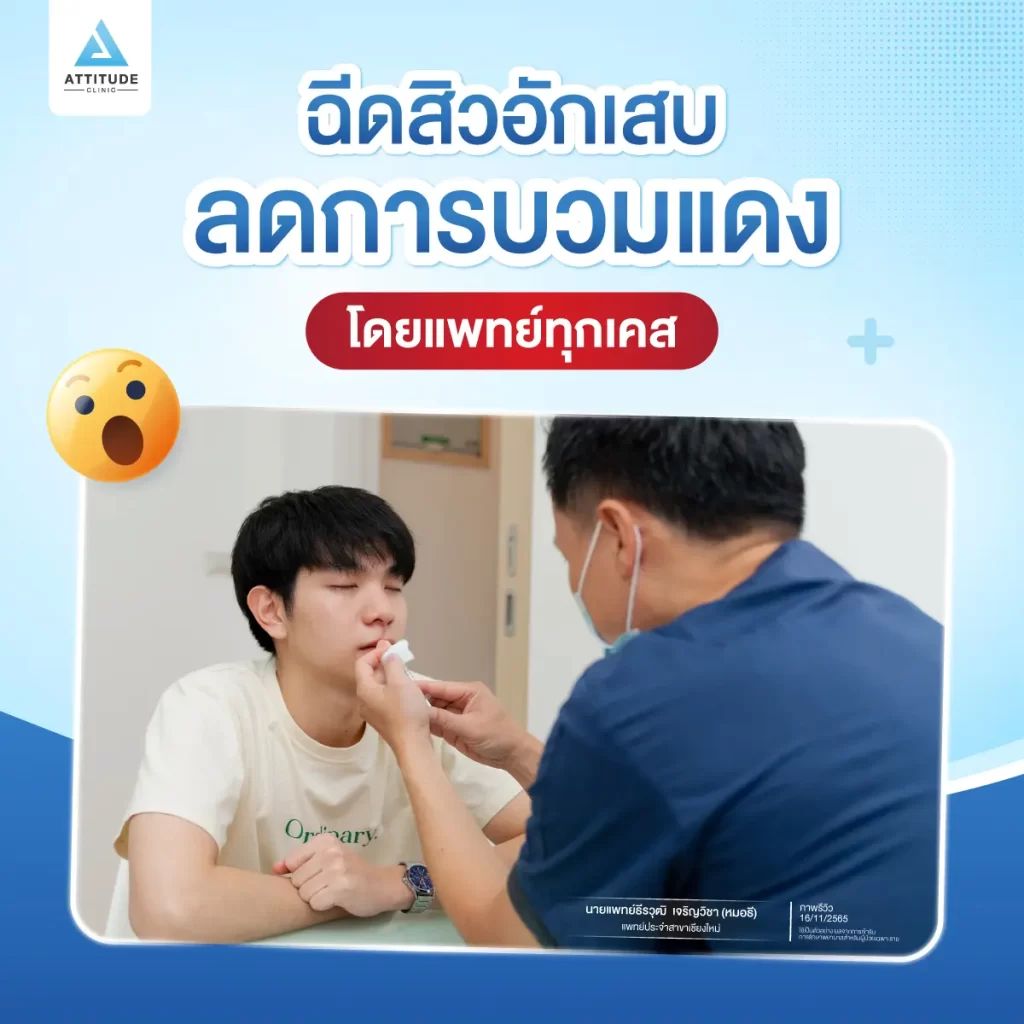 รักษาสิว 7 ขั้นตอน โปรแกรม Light Clear ฉายแสงรักษาสิวอักเสบ สิวอุดตัน สิวผด สิวแพ้ สิวสเตียรอยด์ สิวไหนๆ เราก็ใส่ใจรักษา คุณหมอประเมินพยายามแก้ปัญหาสิวที่ต้นเหตุ ฟื้นฟูผิวให้แข็งแรงสู้กับปัญหาสิว