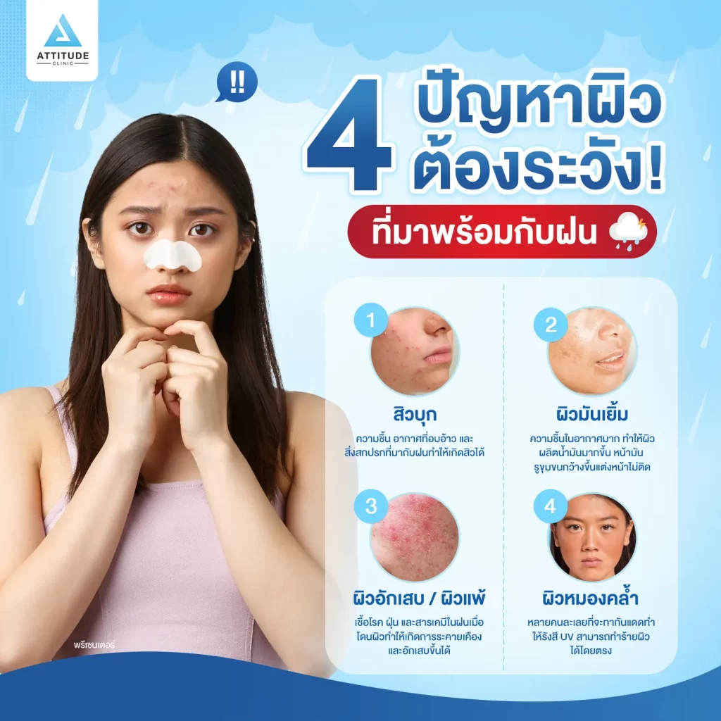 แอททิจูดพารู้ ปัญหาผิวที่มาพร้อมฝนที่ไม่ว่าใครก็ไม่อยากให้เกิดกับตัวเอง