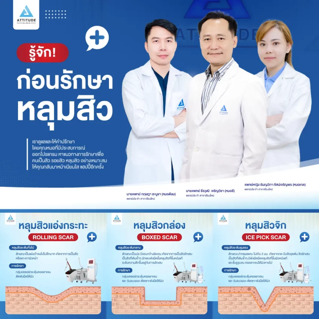 แอททิจูดชวนมาทำความรู้จัก ก่อนรักษา "หลุมสิว"