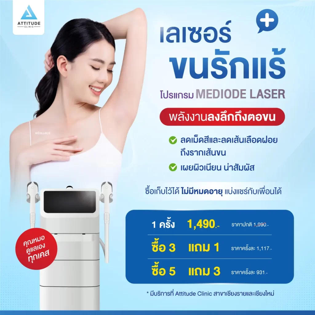 โปรโมชั่น เลเซอร์กำจัดขนรักแร้ MeDiode Laser สำหรับกำจัดขนโดยเฉพาะ ผสมผสาน 2 ความยาวคลื่น คือ 810 nm ลดเม็ดสีเมลานินในรากขน และ 940 nm ลดเส้นเลือดฝอยที่เลี้ยงรากขน เผยผิวเนียน น่าสัมผัส