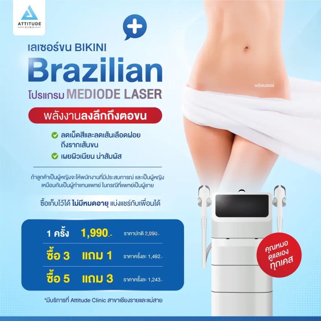 โปรโมชั่น เลเซอร์กำจัดขน Bikini หรือ Brazilian ด้วยเครื่อง MeDiode Laser สำหรับกำจัดขนโดยเฉพาะ ผสมผสาน 2 ความยาวคลื่น คือ 810 nm ลดเม็ดสีเมลานินในรากขน และ 940 nm ลดเส้นเลือดฝอยที่เลี้ยงรากขน เผยผิวเนียน น่าสัมผัสที่ Attitude Clinic