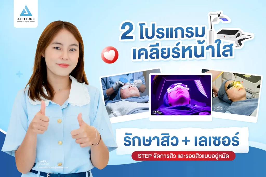 2 โปรแกรมเคลียร์หน้าใส รักษาสิว+เลเซอร์ Step จึ้งรักษาสิว และรอยสิวแบบอยู่หมัด