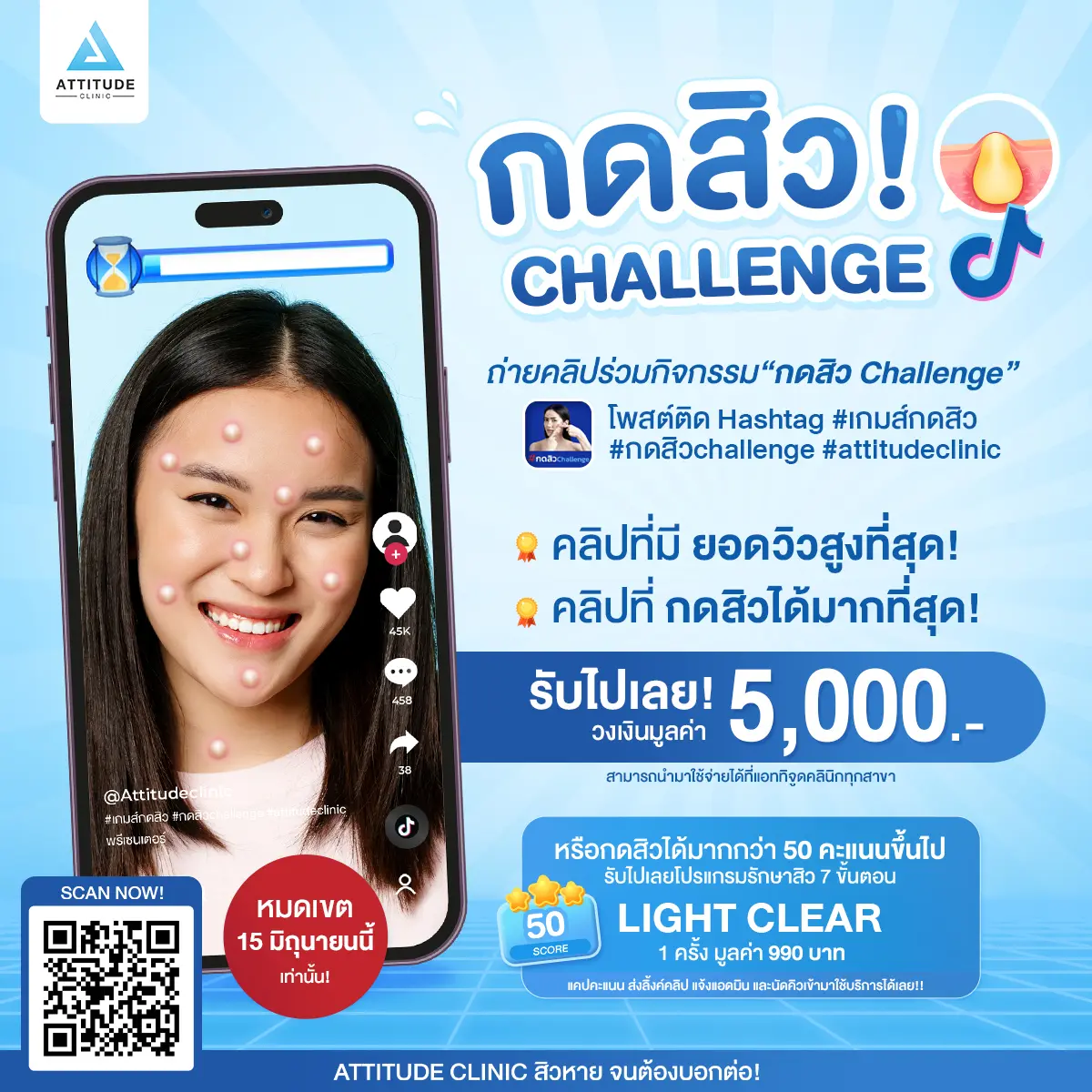 แอททิจูดชวนเล่นเกมส์ กดสิว Challenge  ถ่ายคลิปร่วมกิจกรรมลุ้นรับวงเงินมูลค่ากว่า 5,000 บาท หรือลุ้นรับโปรแกรมรักษาสิว Light Clear ฟรี 1 ครั้ง มูลค่า 990 บาท