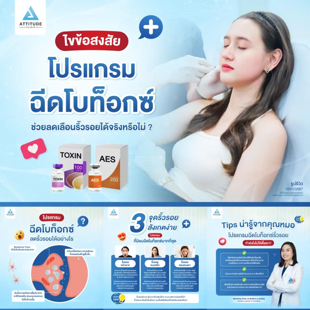 โปรแกรมฉีดโบท็อกซ์ลดริ้วรอยได้จริงหรือไม่ ?