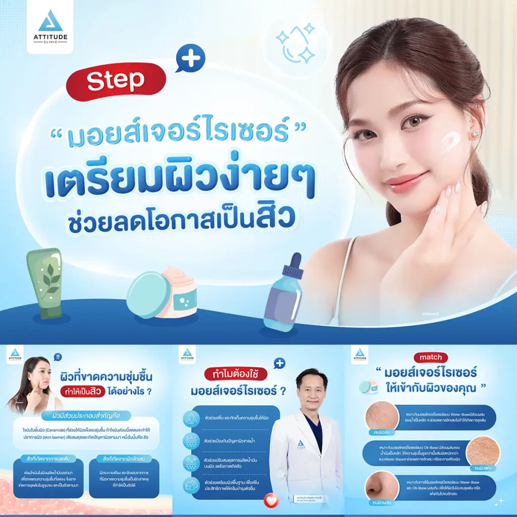 มอยส์เจอร์ไรเซอร์ Step เตรียมผิวง่ายๆ ช่วยลดโอกาสเป็นสิว