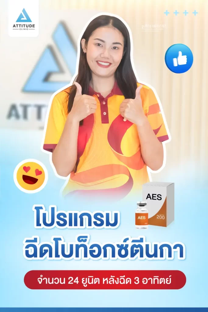 รีวิวโปรแกรมฉีดโบท็อกซ์ตีนกาคุณอีฟ จำนวน 24 Unit หลังฉีด 3 สัปดาห์ ฉีดในปริมาณที่เหมาะสมให้ริ้วรอยตีนกา และริ้วรอยเล็กๆ รอบดวงตาดูจางลง แต่หน้าดูไม่แข็งตึงกับคุณหมอที่ Attitude Clinic